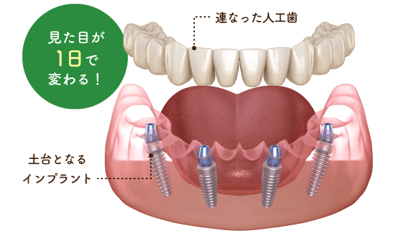 見た目が1日で変わる！