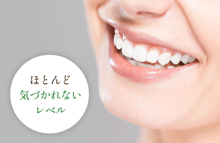 ほとんど気づかれないレベル